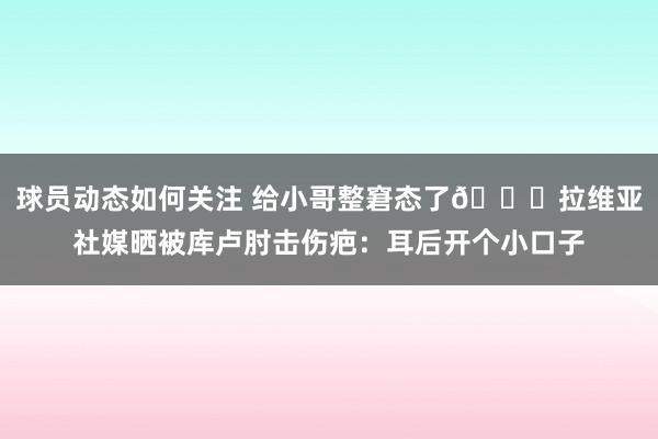 球员动态如何关注 给小哥整窘态了😅拉维亚社媒晒被库卢肘击伤疤：耳后开个小口子